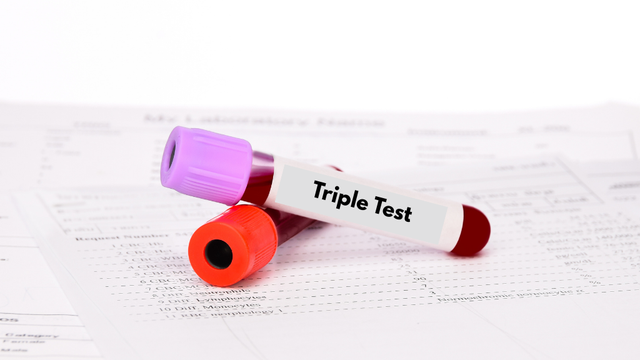 Xét nghiệm triple test hết bao nhiêu tiền? Mức chi phí thực tế hiện nay