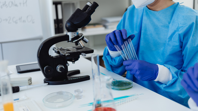 Xét nghiệm vi sinh là gì? Các loại xét nghiệm vi sinh