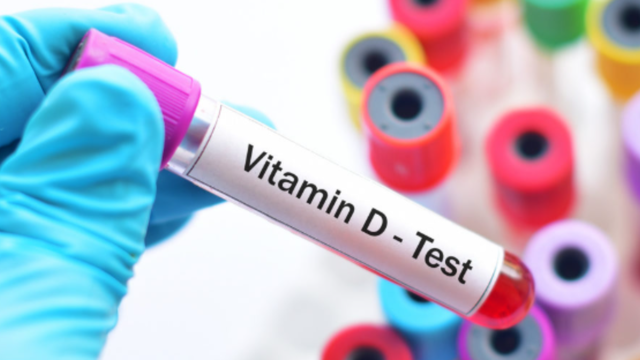 Xét nghiệm vitamin D là gì? Vai trò với sức khỏe toàn diện 