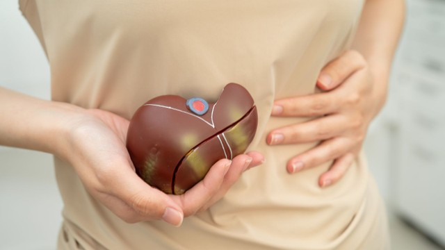 Xơ gan F2 có chữa được không? Có nguy hiểm không?