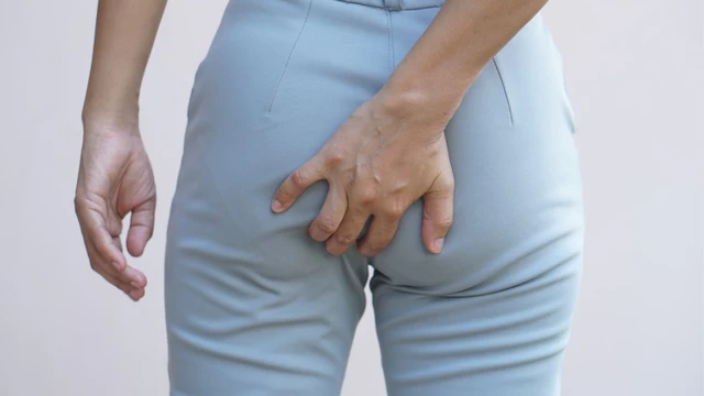 U nhú hậu môn là gì? Nguyên nhân, triệu chứng, điều trị và các biện pháp phòng ngừa