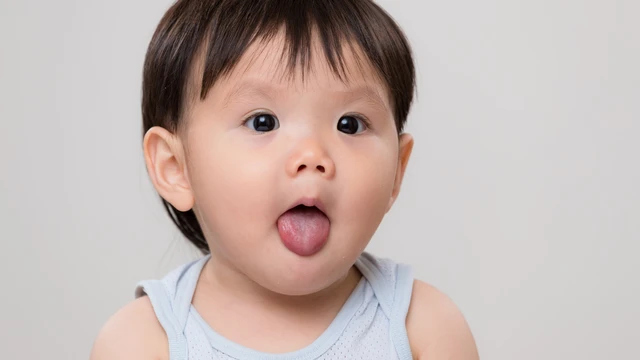 Dính thắng lưỡi độ 1 có cần cắt không? Dấu hiệu nhận biết trẻ bị dính thắng lưỡi