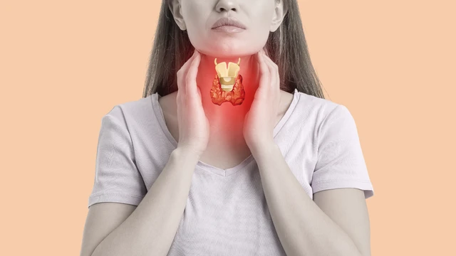 Vôi hóa tuyến giáp kiêng ăn gì để bảo vệ sức khỏe tuyến giáp? 