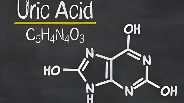 Axit uric cao bao nhiêu thì bị gout? 