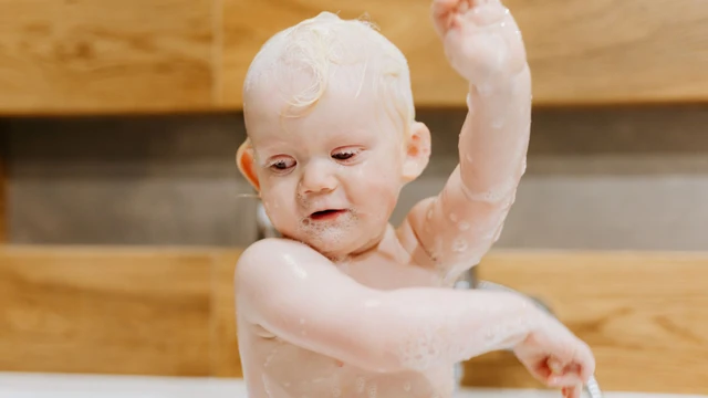 Bệnh bạch tạng sống được bao lâu? Khi nào cần đi khám và theo dõi y tế?