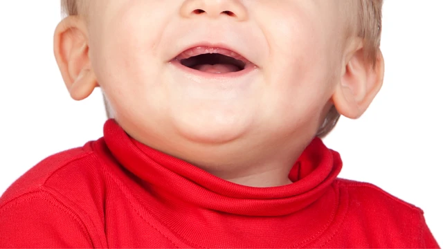 Bé chậm mọc răng có phải thiếu canxi không? Nguyên nhân trẻ chậm mọc răng