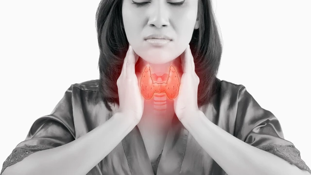 Bướu cường giáp là gì? Nguyên nhân, chẩn đoán và cách điều trị