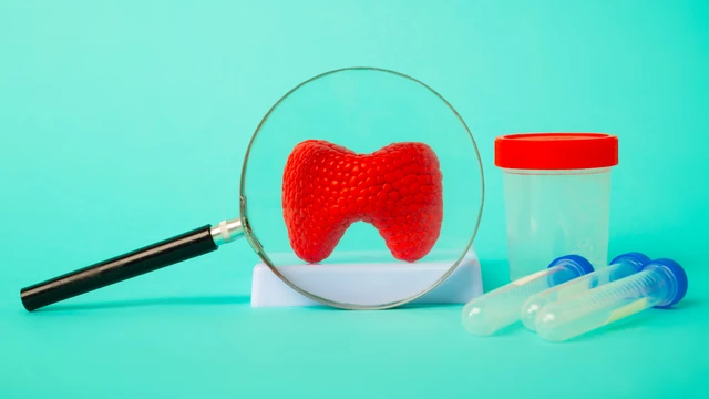 Bướu tuyến giáp là gì? Triệu chứng, nguyên nhân và cách điều trị
