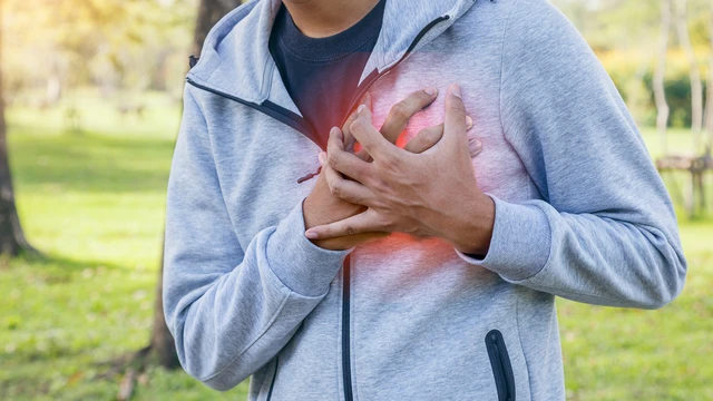 Đột quỵ tim là gì? Nguyên nhân, triệu chứng và cách phòng ngừa