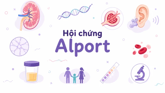 Hội chứng Alport là gì? Nguyên nhân và cách phòng ngừa hiệu quả