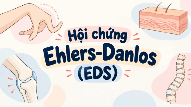 benh_a_z_hoi_chung_ehlers_danlos_1_06274d8c84