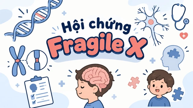 benh_a_z_hoi_chung_fragile_x_1_614953b3a0