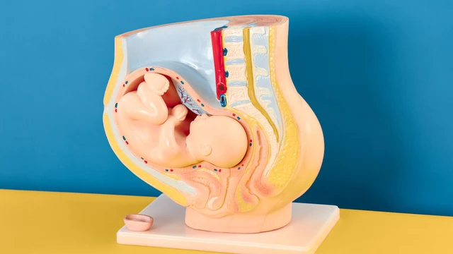 Hội chứng rượu bào thai là gì? Nguyên nhân, triệu chứng và cách điều trị