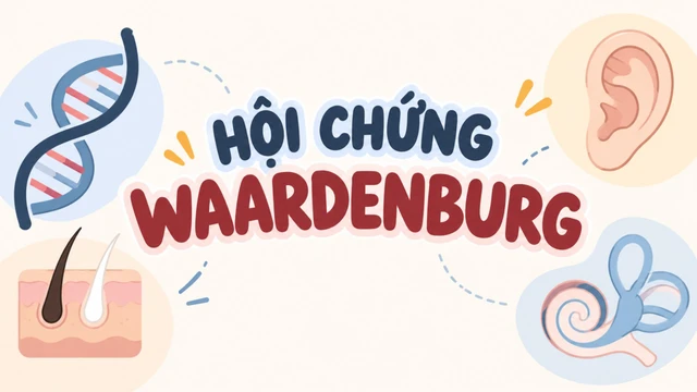 benh_a_z_hoi_chung_waardenburg_1_ba958afa7f