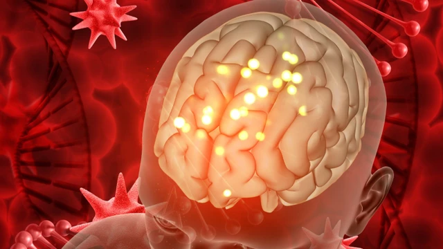 Nhiễm khuẩn huyết não mô cầu là gì? Nguyên nhân, triệu chứng và cách điều trị
