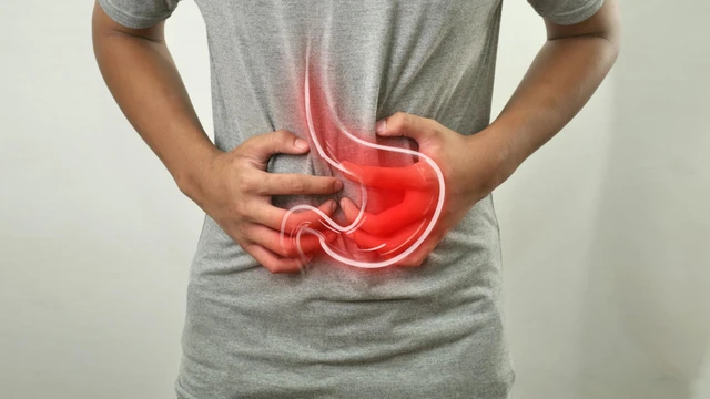 Viêm dạ dày mạn tính là gì? Nguyên nhân, triệu chứng và cách điều trị