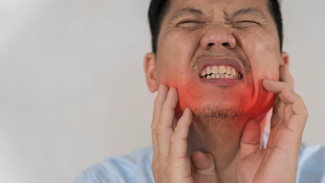 Viêm dây thần kinh số 5 là gì? Nguyên nhân và cách phòng ngừa hiệu quả