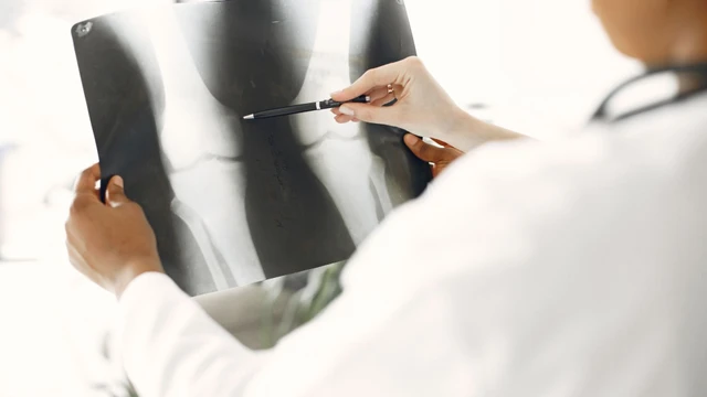 Bệnh còi xương: Triệu chứng, nguy cơ, cách điều trị và phòng ngừa