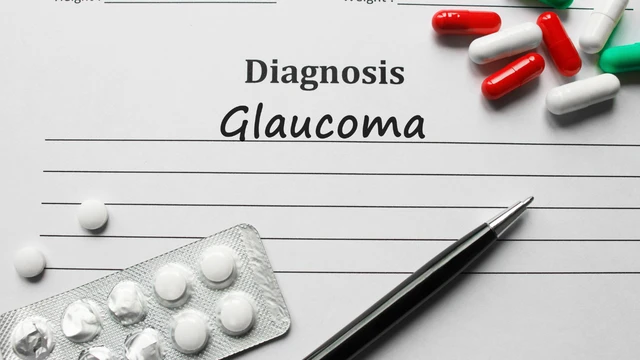 Bệnh glocom là gì? Nguyên nhân, triệu chứng và cách điều trị