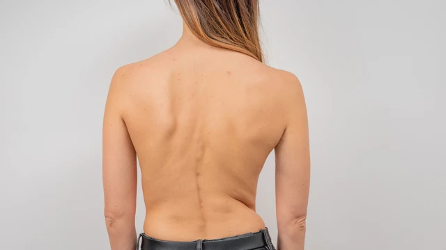 Bệnh loãng xương có nguy hiểm không? Những biến chứng bạn cần biết