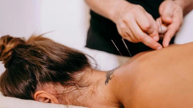Bệnh Parkinson có châm cứu được không? Lợi ích của châm cứu đối với người bệnh