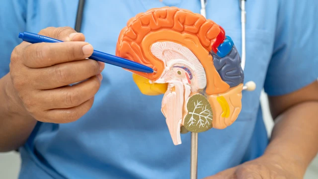Bệnh thiểu năng tuần hoàn não có nguy hiểm không​?