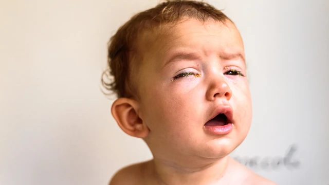 Bệnh viêm màng não mủ có chữa được không?