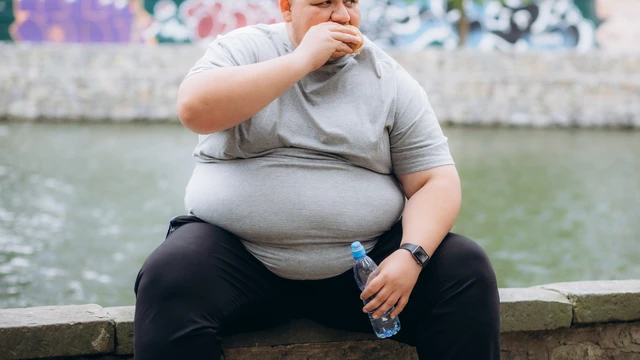 Béo phì độ 3 là gì? Cách nhận biết, nguyên nhân, điều trị và phòng ngừa