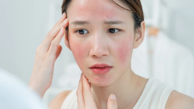 Bị dị ứng thức ăn có được tắm không? Hướng dẫn an toàn