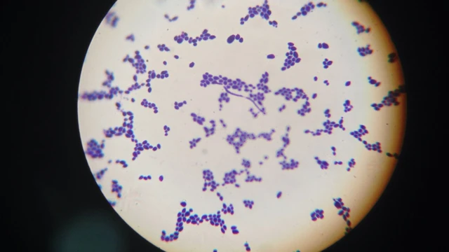 Bị nấm Candida có ảnh hưởng đến kinh nguyệt không? Khi nào cần đi khám phụ khoa?