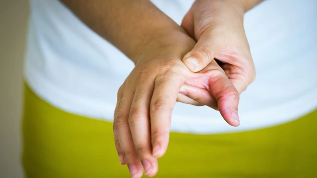 Biến chứng sau mổ hội chứng ống cổ tay: Nguyên nhân và cách phòng tránh