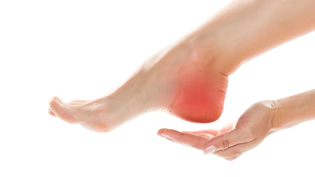 Bong gân gót chân: Nguyên nhân, triệu chứng và cách xử trí