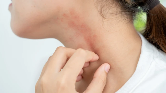 Các dấu hiệu nhiễm trùng da thường gặp cần nhận biết sớm