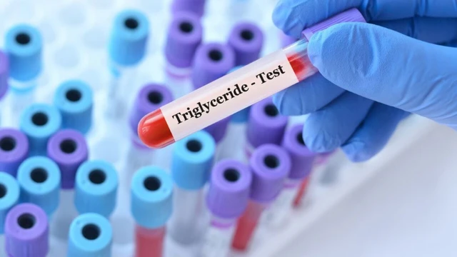Các dấu hiệu triglyceride cao cảnh báo nguy cơ tim mạch cần lưu ý