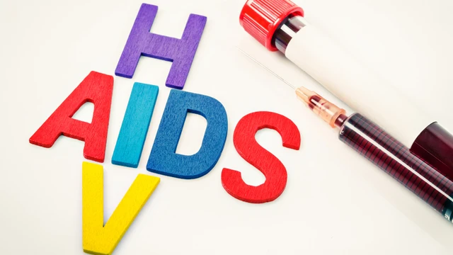 Các giai đoạn HIV AIDS: Nhận biết sớm để điều trị hiệu quả và kéo dài sự sống