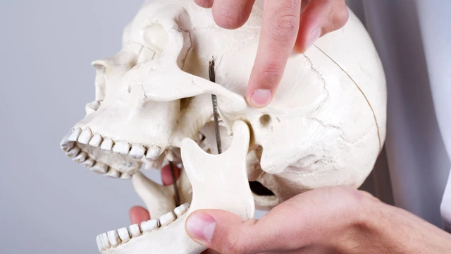 Cách điều trị viêm khớp thái dương hàm hiệu quả và an toàn