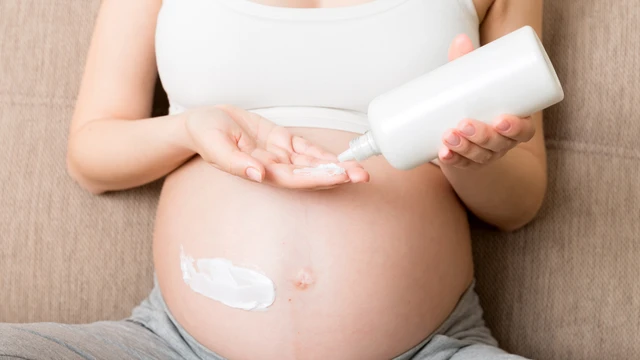 Cách trị rạn da an toàn và hiệu quả