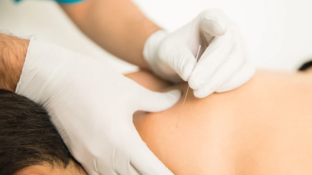 Châm cứu xong có tắm được không? Những điều cần tránh sau khi thực hiện