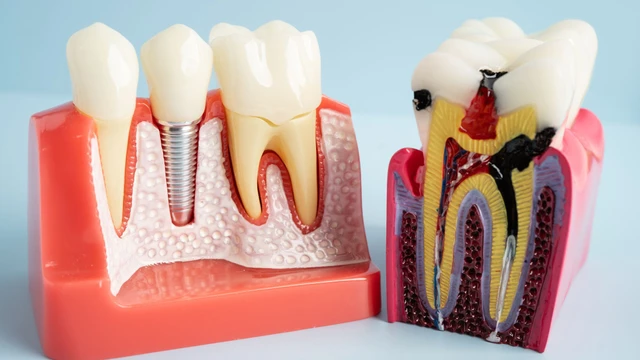 Chân răng là gì? Những thông tin cần biết