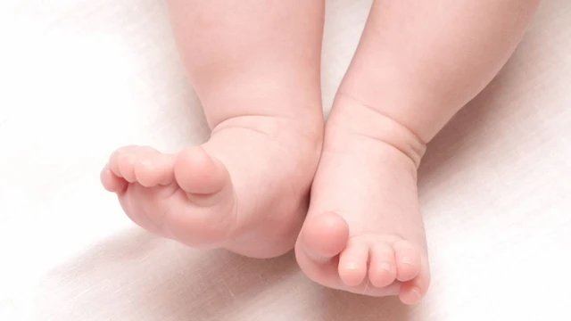 Chân vòng kiềng ở trẻ: Dấu hiệu, nguyên nhân và cách khắc phục hiệu quả