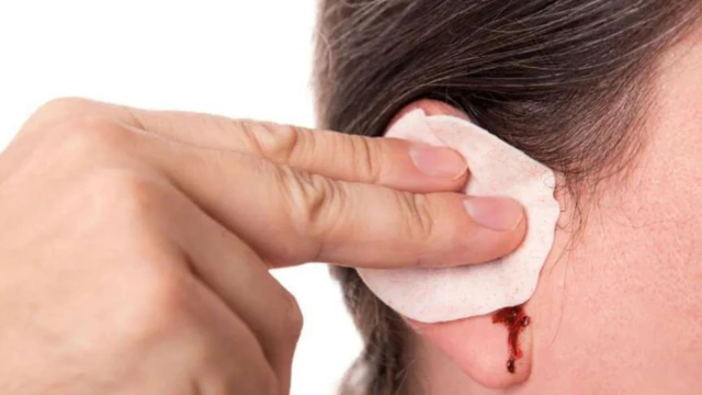 Chảy máu trong tai: Nguyên nhân, dấu hiệu và cách xử lý hiệu quả