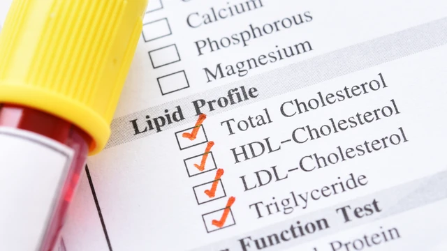 Cholesterol toàn phần là gì​? Tại sao cần kiểm tra định lượng cholesterol toàn phần máu?