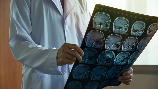 Chụp MRI não cho bé có ảnh hưởng gì không? Giải đáp chi tiết