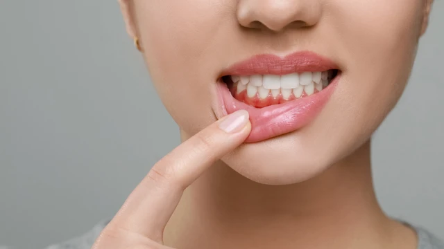 Có nên nặn mủ chân răng? Cảnh báo nguy hiểm từ chuyên gia