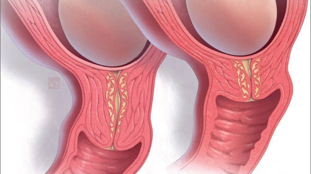 Cổ tử cung bao nhiêu là ngắn? Nguy cơ và cách điều trị