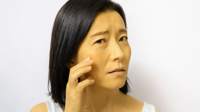 Da vàng là dấu hiệu của bệnh gì? Nguyên nhân thường gặp và cách xử trí
