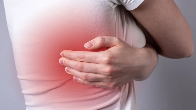 Đau cơ liên sườn: Nguyên nhân, triệu chứng, chẩn đoán và điều trị