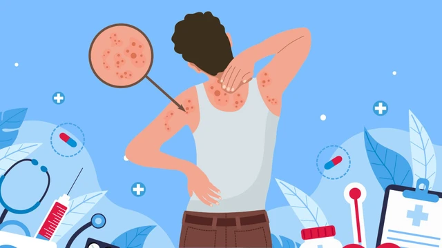 Đau sau zona có phải chỉ là “chuyện nhỏ” như nhiều người vẫn nghĩ?