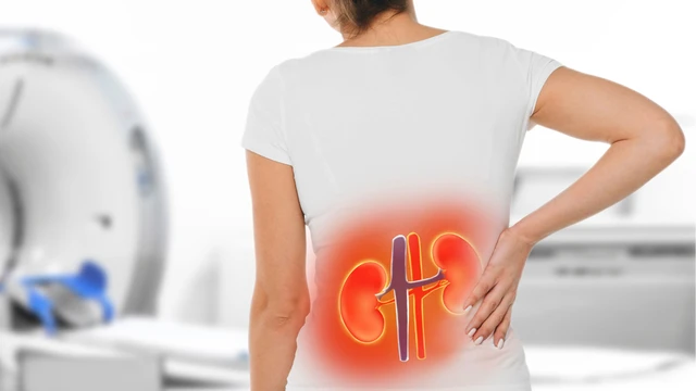Đau thận ở vị trí nào? Dấu hiệu nhận biết và cách phòng bệnh