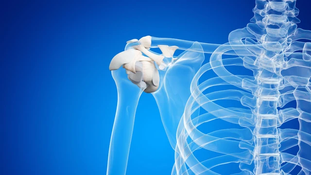 Dây chằng khớp vai: Chức năng, vai trò và các chấn thương thường gặp
